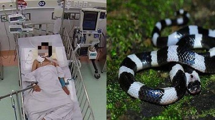 chau be bi ran can anh 1