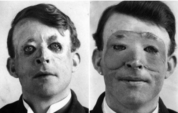 phau thuat tham my anh 1