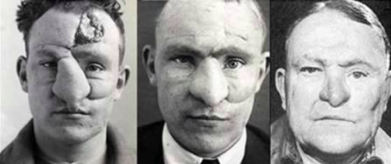 phau thuat tham my anh 2