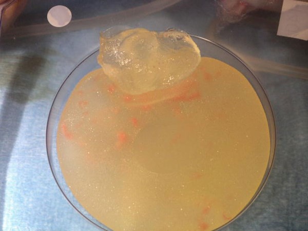 phau thuat tham my anh 3