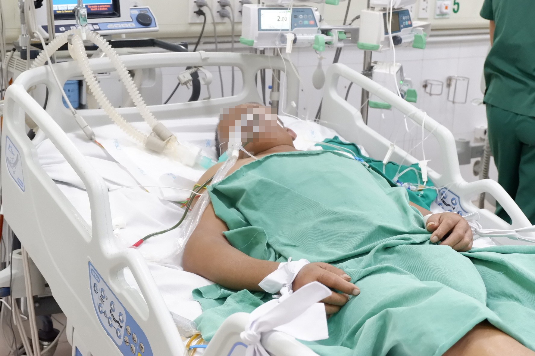 tinh hinh dich covid-19 anh 2