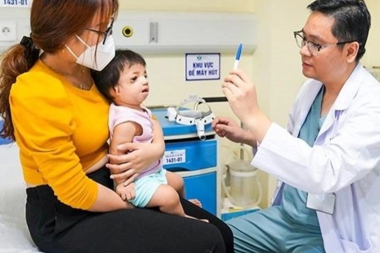 dị tật sọ hiếm gặp ảnh 1 di tat so hiem gap anh 1