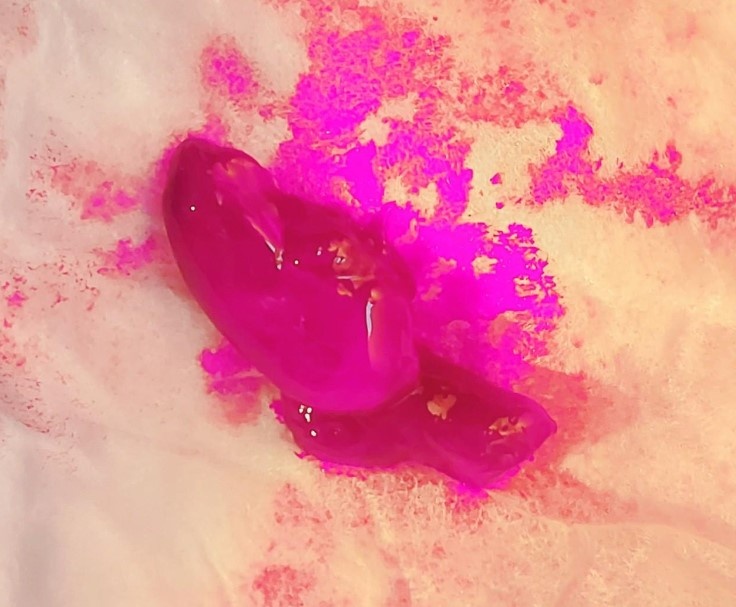 dia chui vao vung kin anh 1