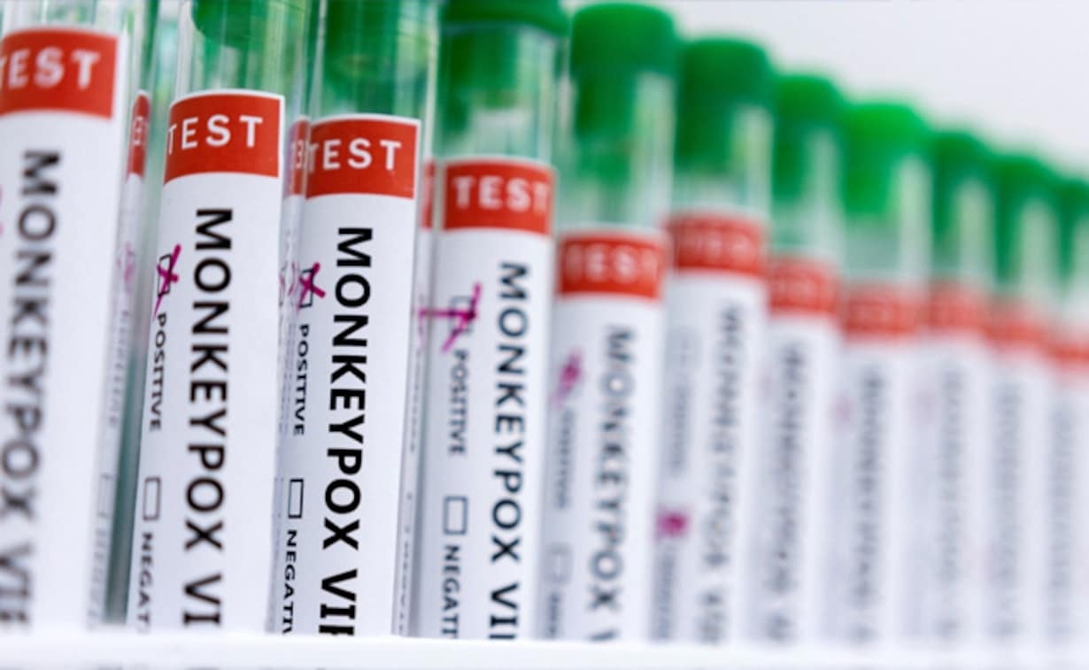 Bo Y te yeu cau dieu tra nguoi tiep xuc neu phat hien ca dau mua khi hinh anh