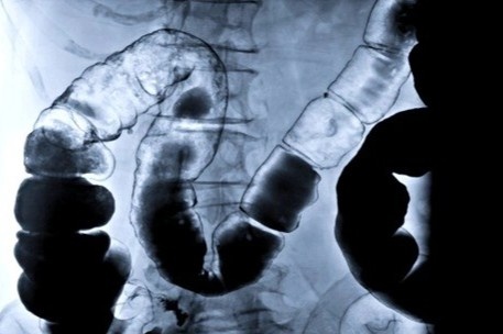 thut rua bang ca phe anh 4