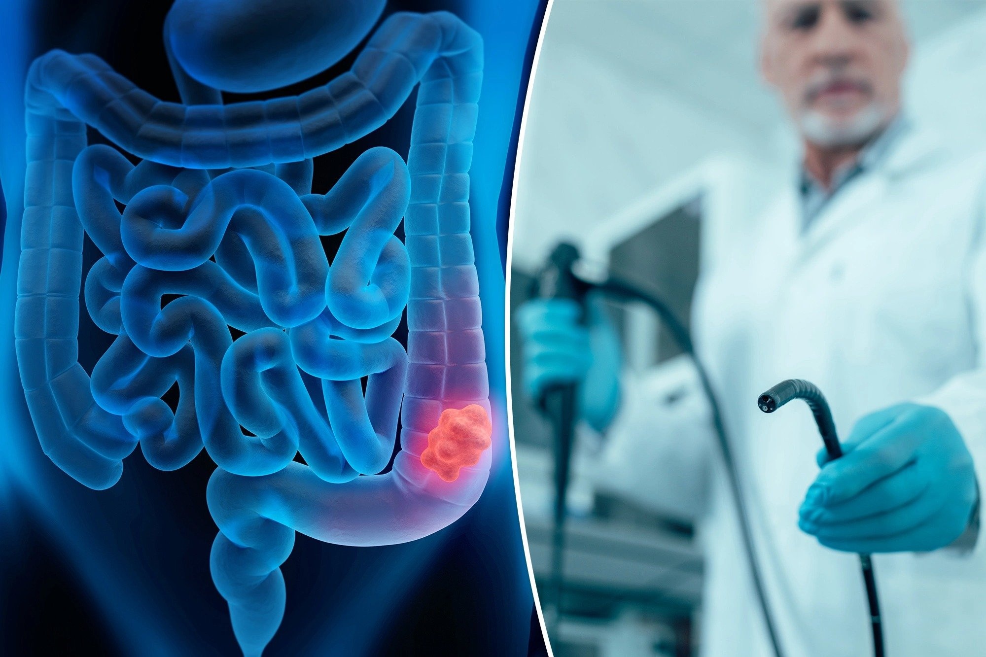 Noi soi dai trang co the khong hieu qua nhu chung ta nghi hinh anh