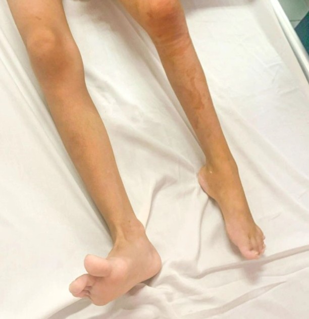 be gai mac benh hiem anh 1