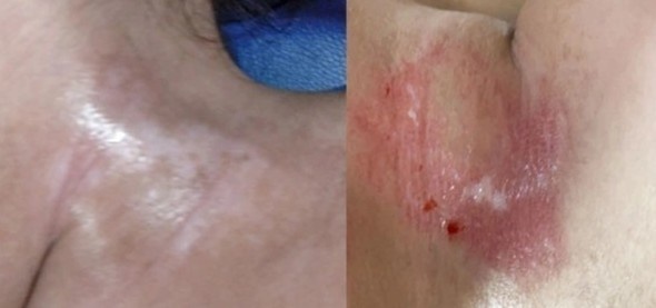 tre em bong hoa chat anh 2