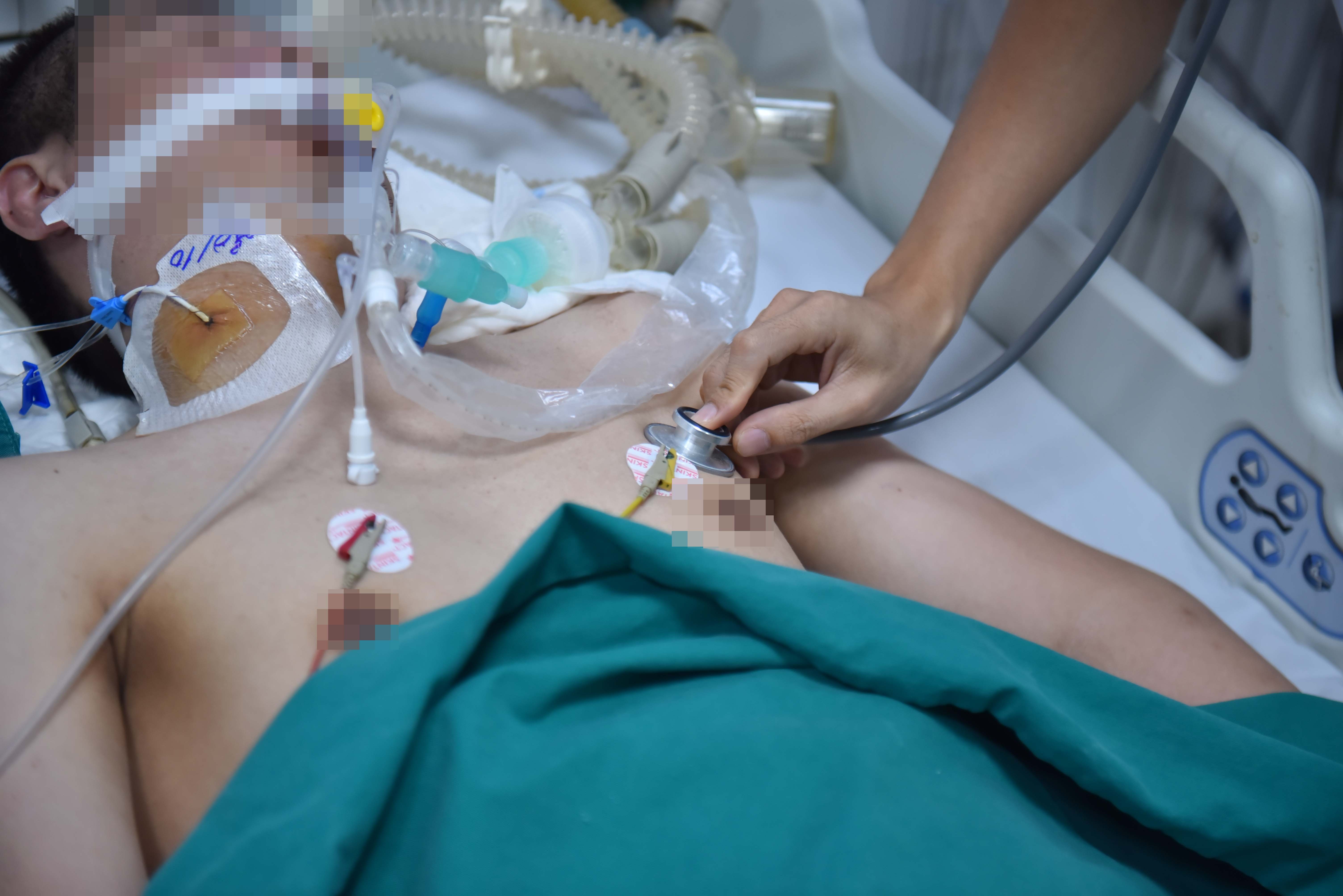 Loc mau, nguy co tu vong vi mac sot xuat huyet hinh anh