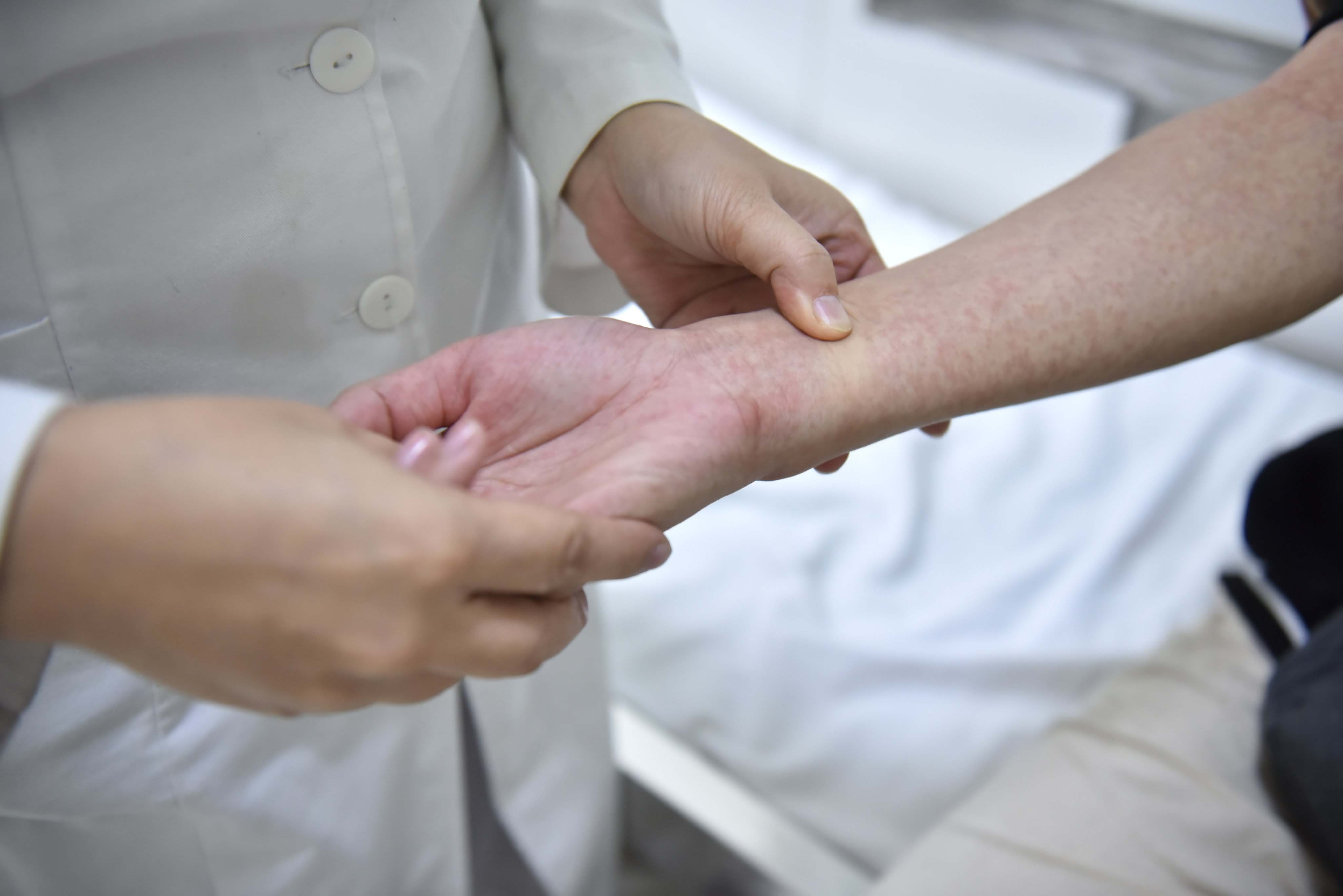 dịch bệnh sốt xuất huyết ảnh 8 dich benh sot xuat huyet anh 8