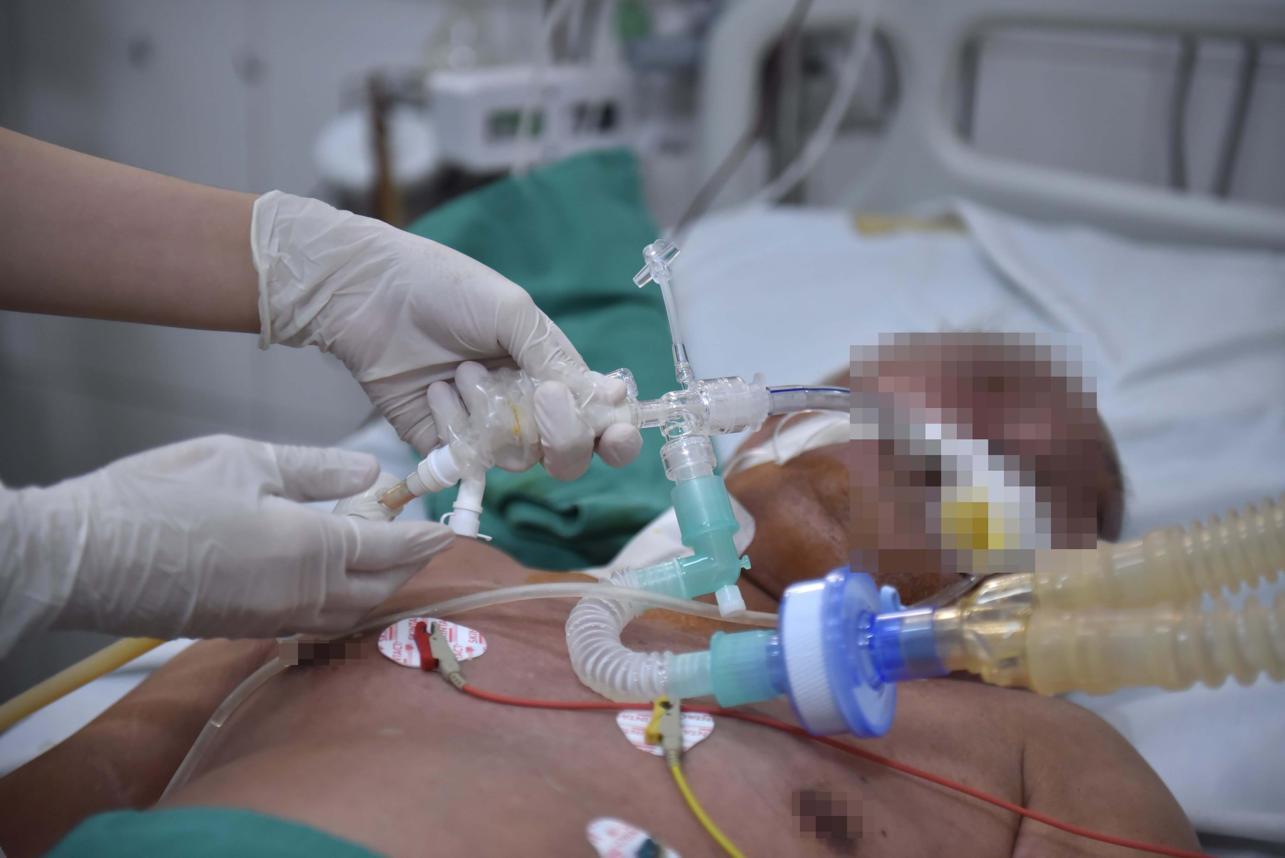 dich benh sot xuat huyet anh 1