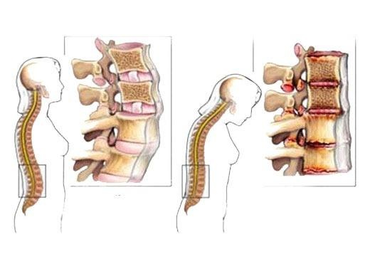 dan van phong dau lung anh 1