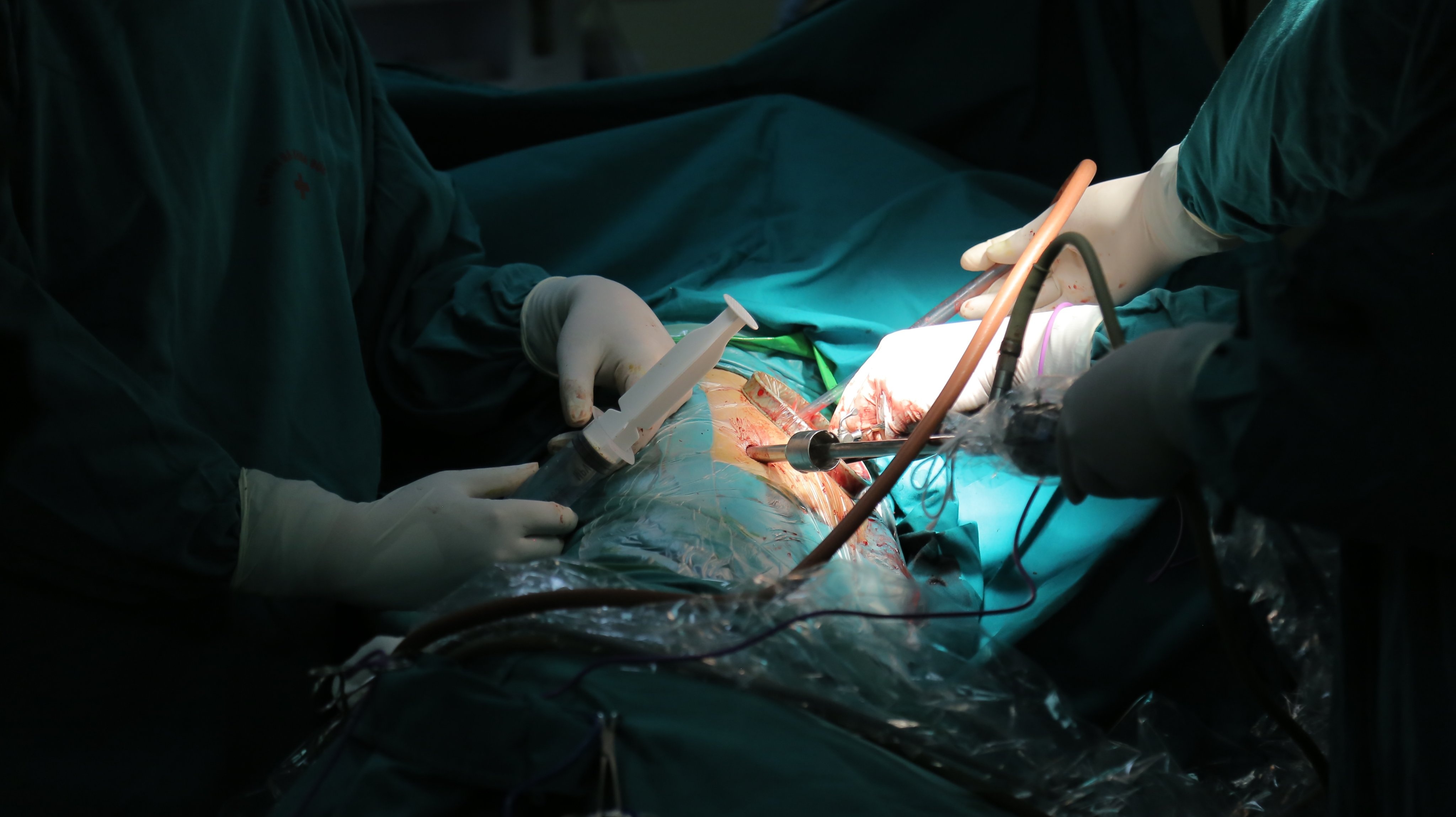 Lien tiep 2 ca nhap vien voi phoi dong dac, nghi di chung Covid-19 hinh anh