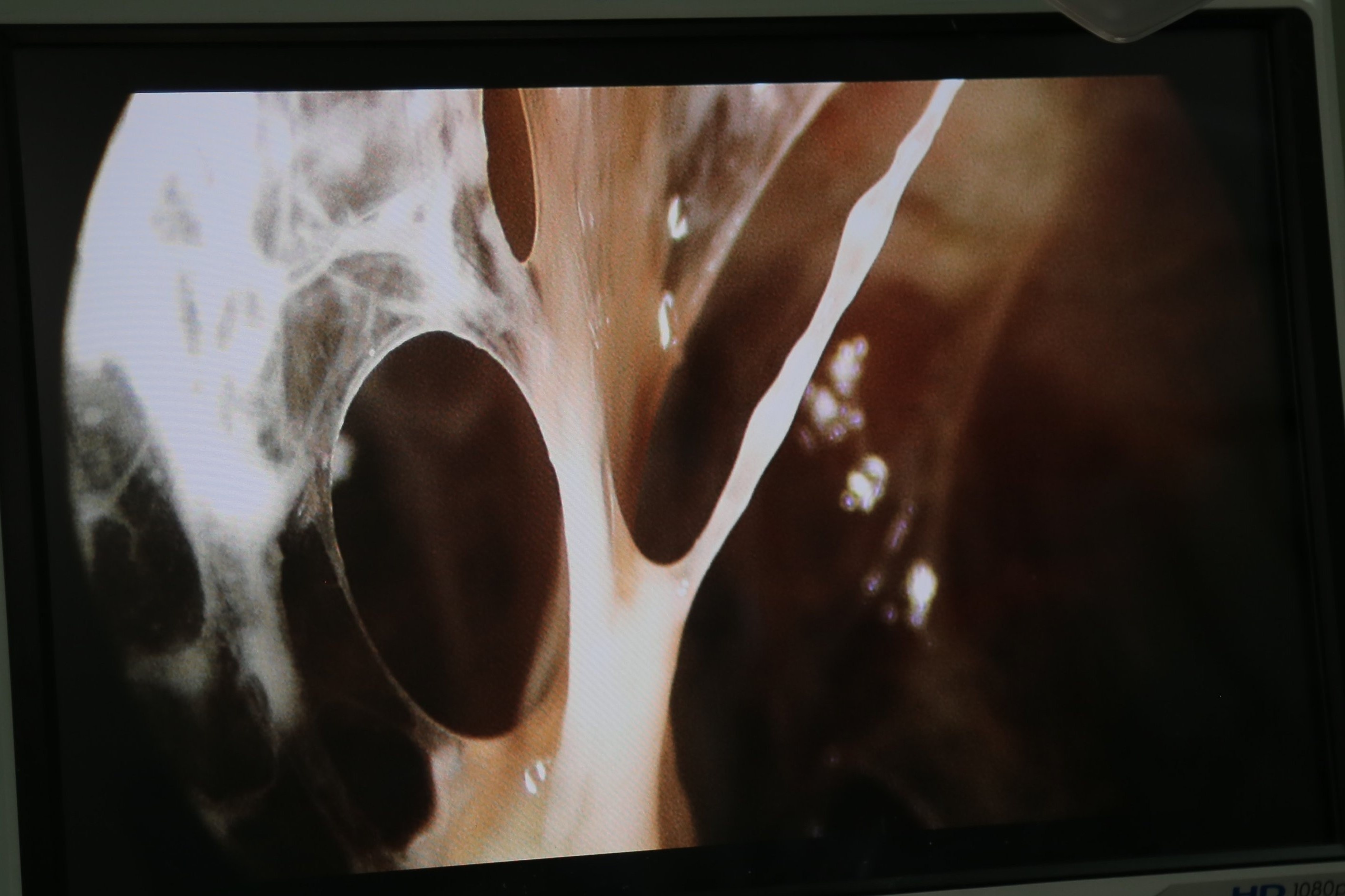 kho tho di chung covid-19 anh 1