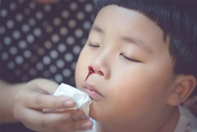 Xu tri chay mau cam trong thoi tiet lanh hinh anh