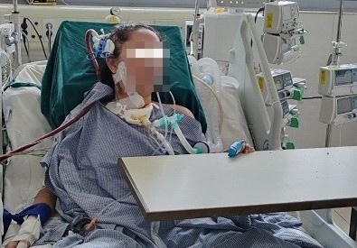 Tu dieu tri cum, benh nhan phai chay tim phoi nhan tao 37 ngay hinh anh