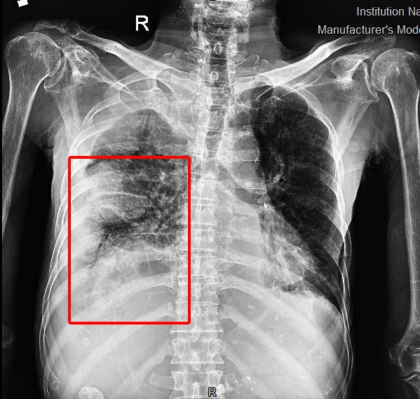 nga trong nha tam anh 1