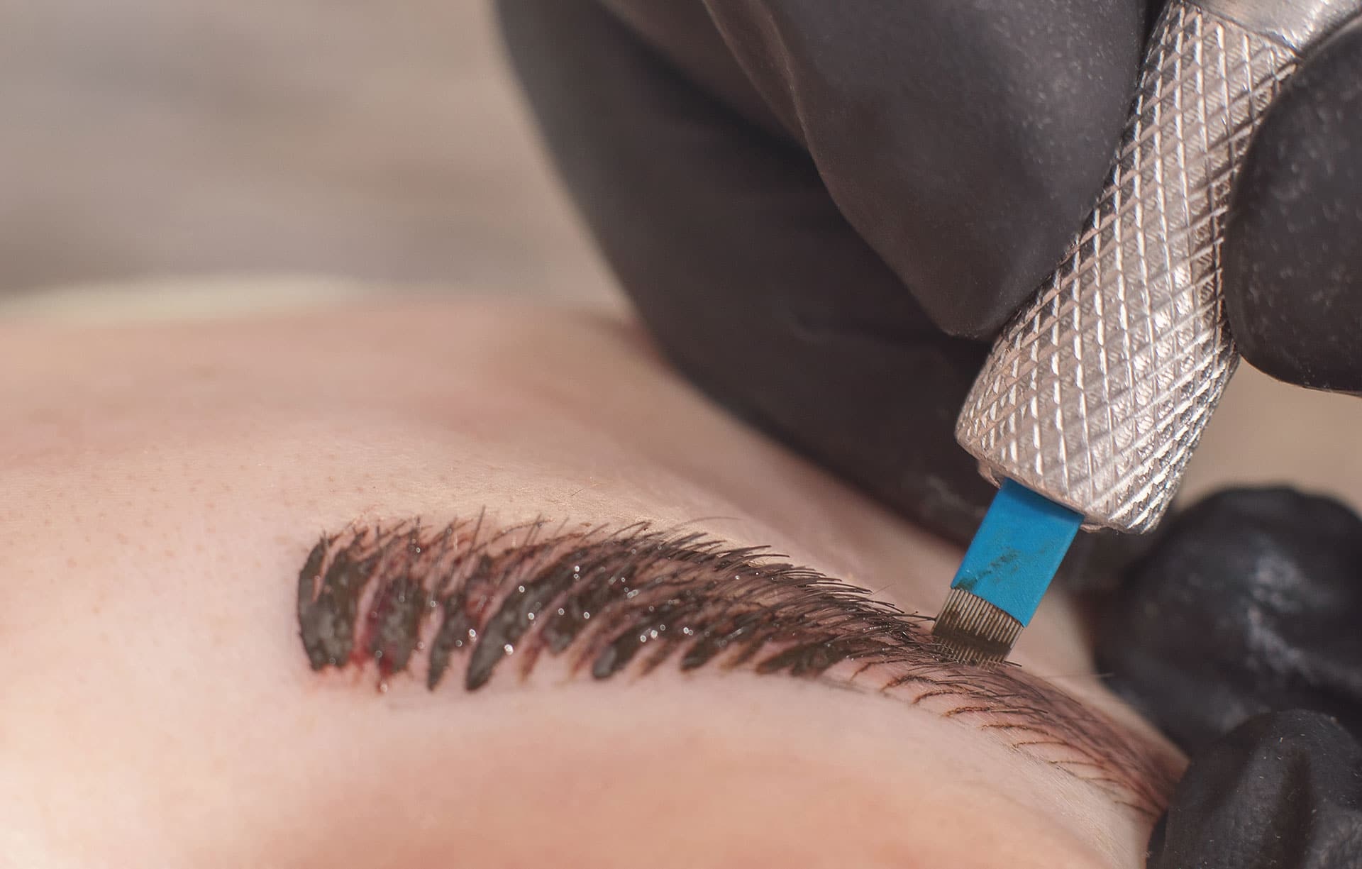 Nhung nguy co tu thu thuat dieu khac chan may hinh anh