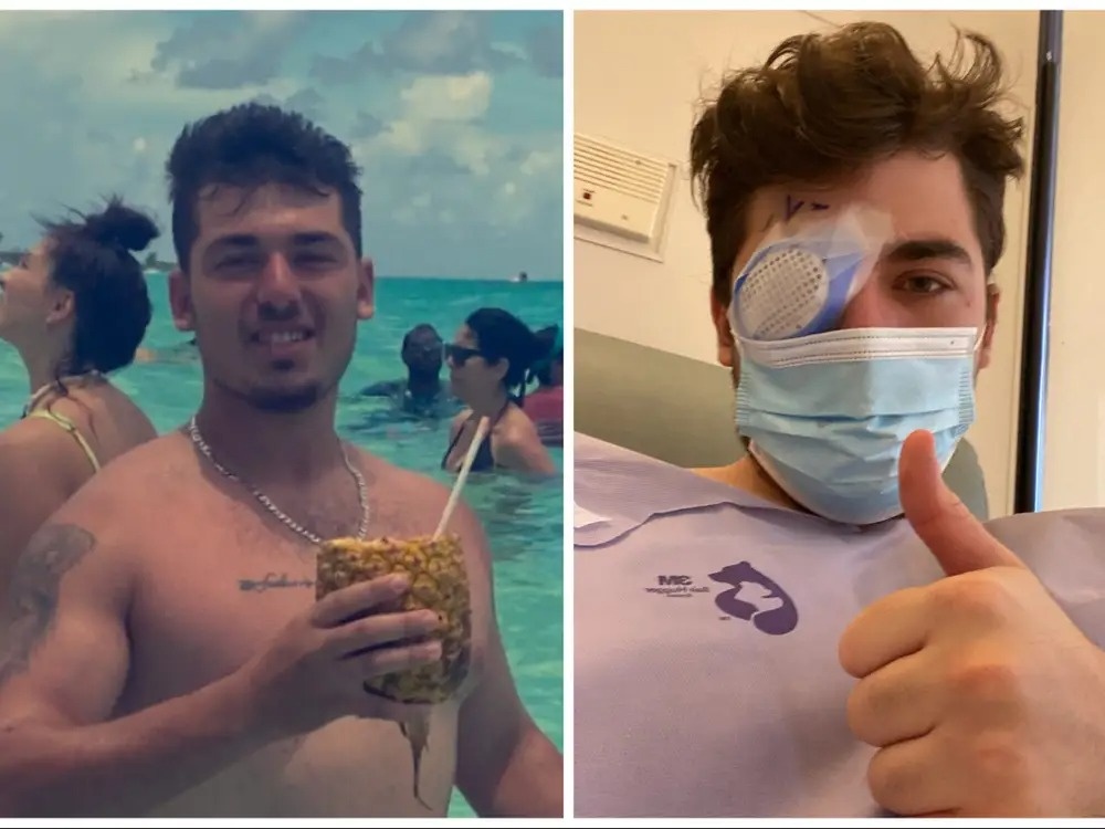 deo ap trong khi ngu anh 1