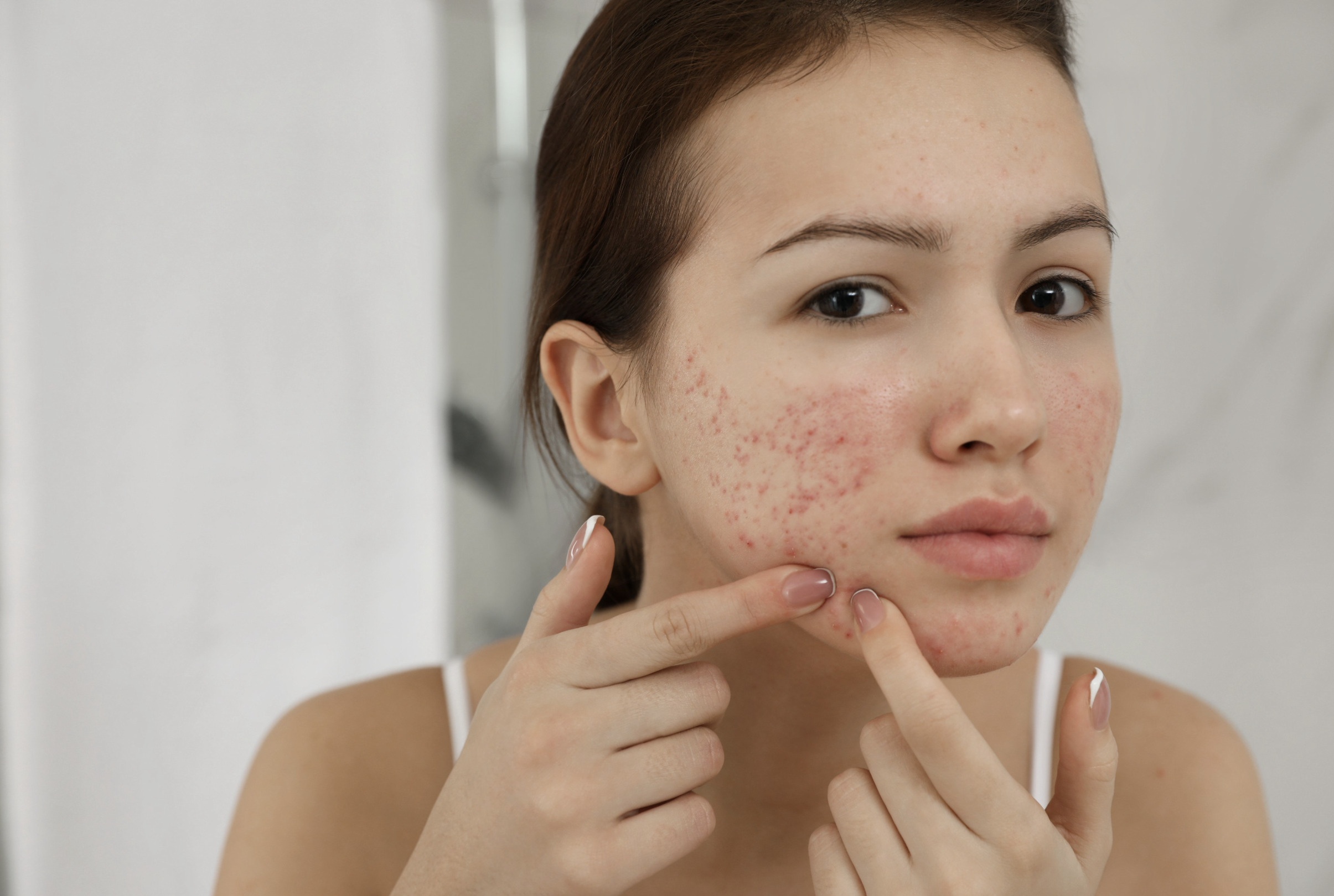 tri da mun day thi anh 2