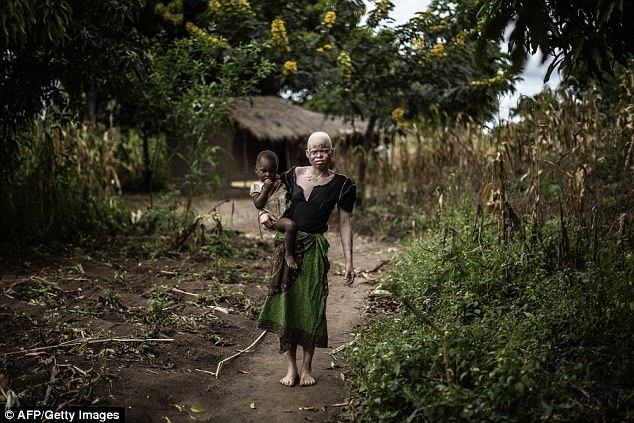 Cô Mainasi bế đứa con 2 tuổi bên ngoài nơi ở. 