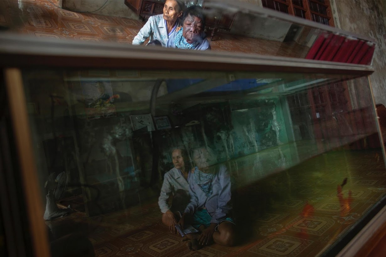 Bà Dang Thi Quang va con trai Nguyen Van Binh tại ngôi nhà ở tỉnh Quảng Bình. Bố của anh Binh từng là chiến sĩ trong đội vận chuyển, tiếp tế ở khu vực mà Mỹ rải chất độc da cam. Chất độc da cam không chỉ tác động đến các cựu chiến binh, nó để lại hậu quả đối với những thế hệ con cháu của họ. 