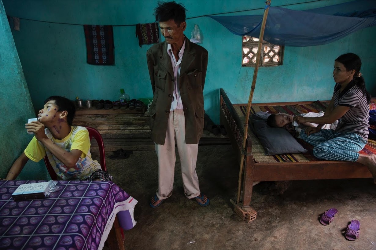 Ông Le Van Dan là người lính từng tiếp xúc trực tiếp với chất độc vào ngày máy bay Mỹ phun nó xuống các cánh rừng. Hai người cháu trai của ông Dan bị dị tật bẩm sinh do ảnh hưởng dioxin.