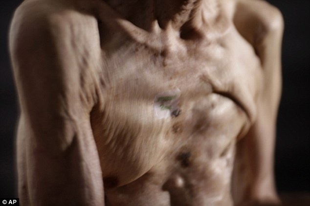 Mỗi ngày, vợ của Taniguchi phải bôi chất dưỡng ẩm lên người chồng vào mỗi sáng để giảm tình trạng sưng tấy và rát da.