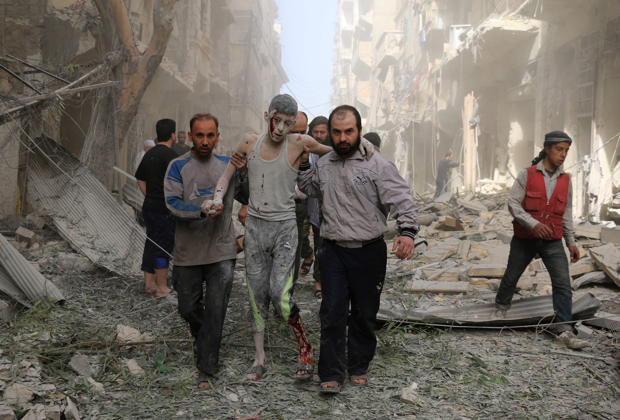 Ảnh bé trai Syria khóc vì mất người thân ảnh 2 Anh be trai Syria khoc vi mat nguoi than anh 2