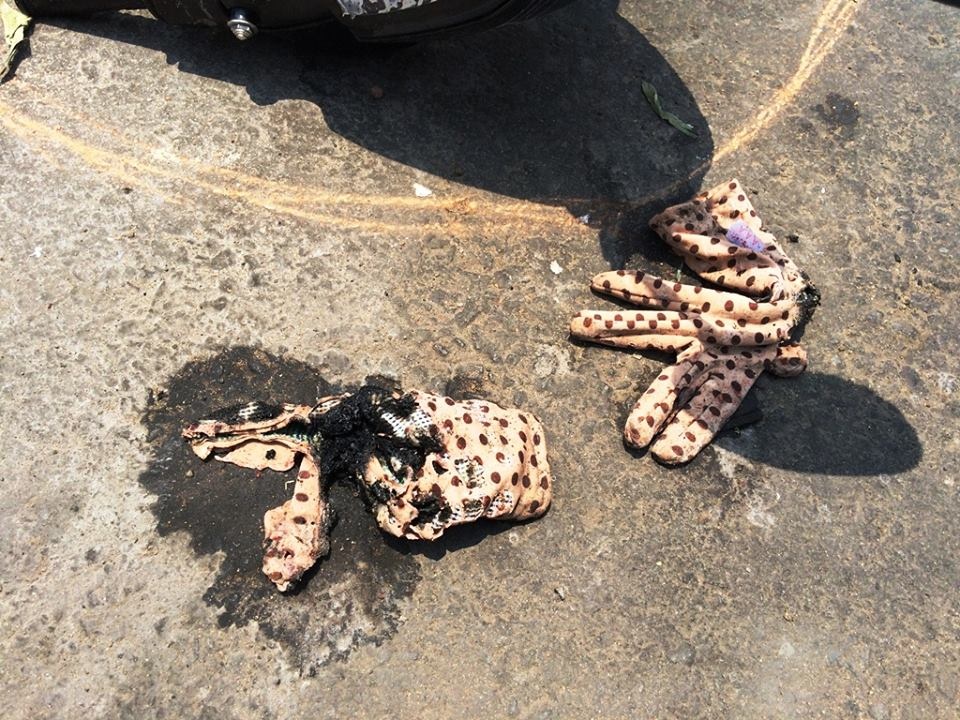 2 thieu nu nghi bi tat axit anh 2