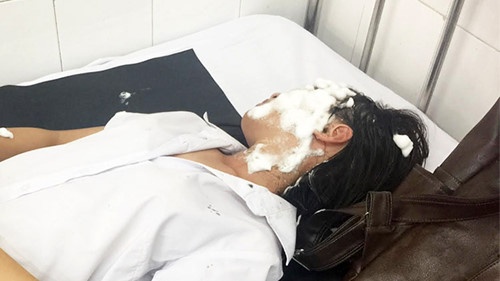 co gai bi tat axit anh 2