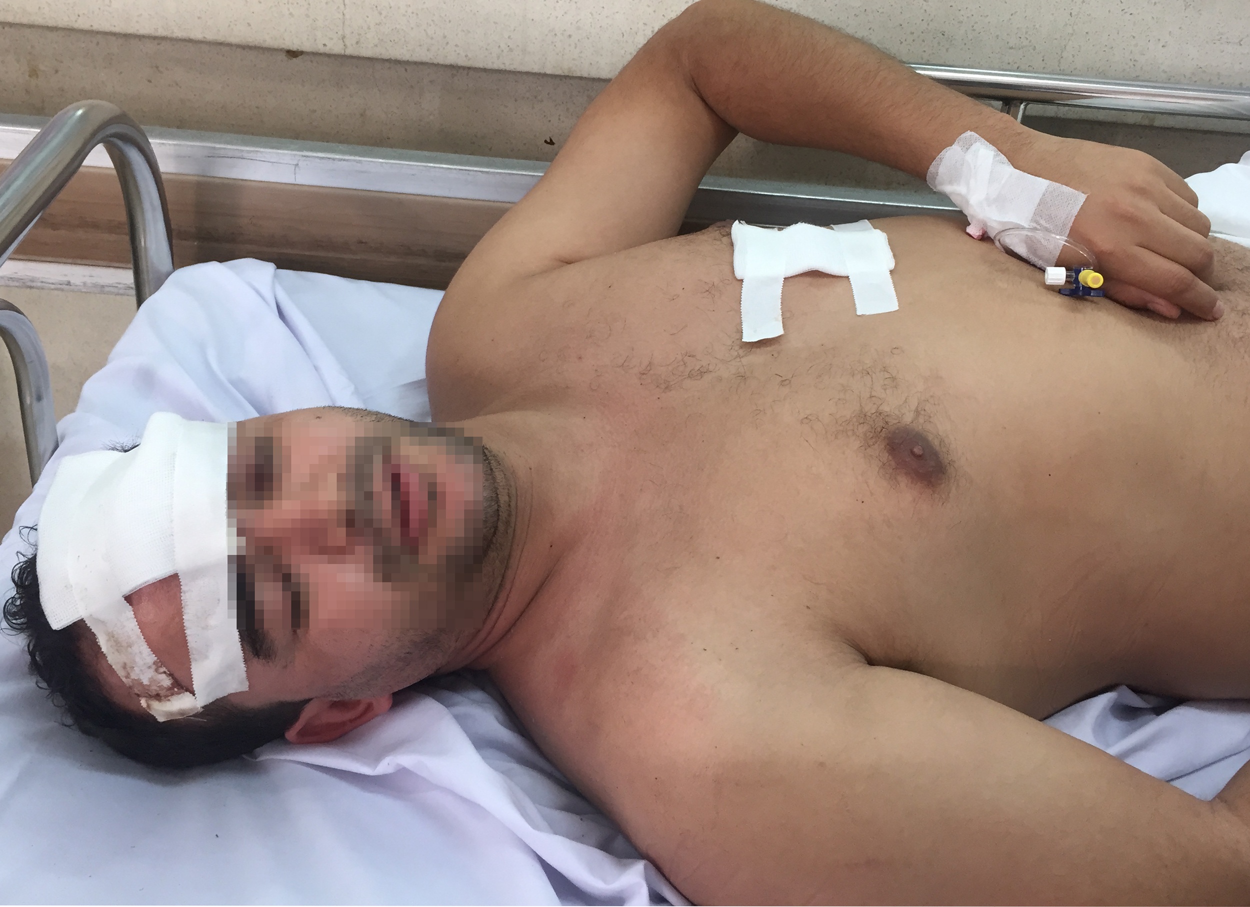 Cuop xong vao chung cu dam nguoi nuoc ngoai o Sai Gon hinh anh