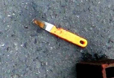 nam thanh niên bị đâm trọng thương ảnh 2 nam thanh nien bi dam trong thuong anh 2