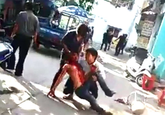 Clip vu dam chem o Binh Tan hinh anh