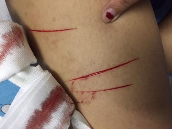 Nu sinh to bi ke bien thai rach dui trong dem hinh anh