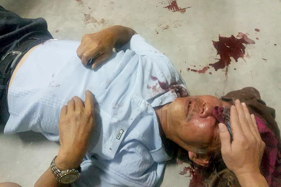 cu ong bi danh den ngat xiu anh 1