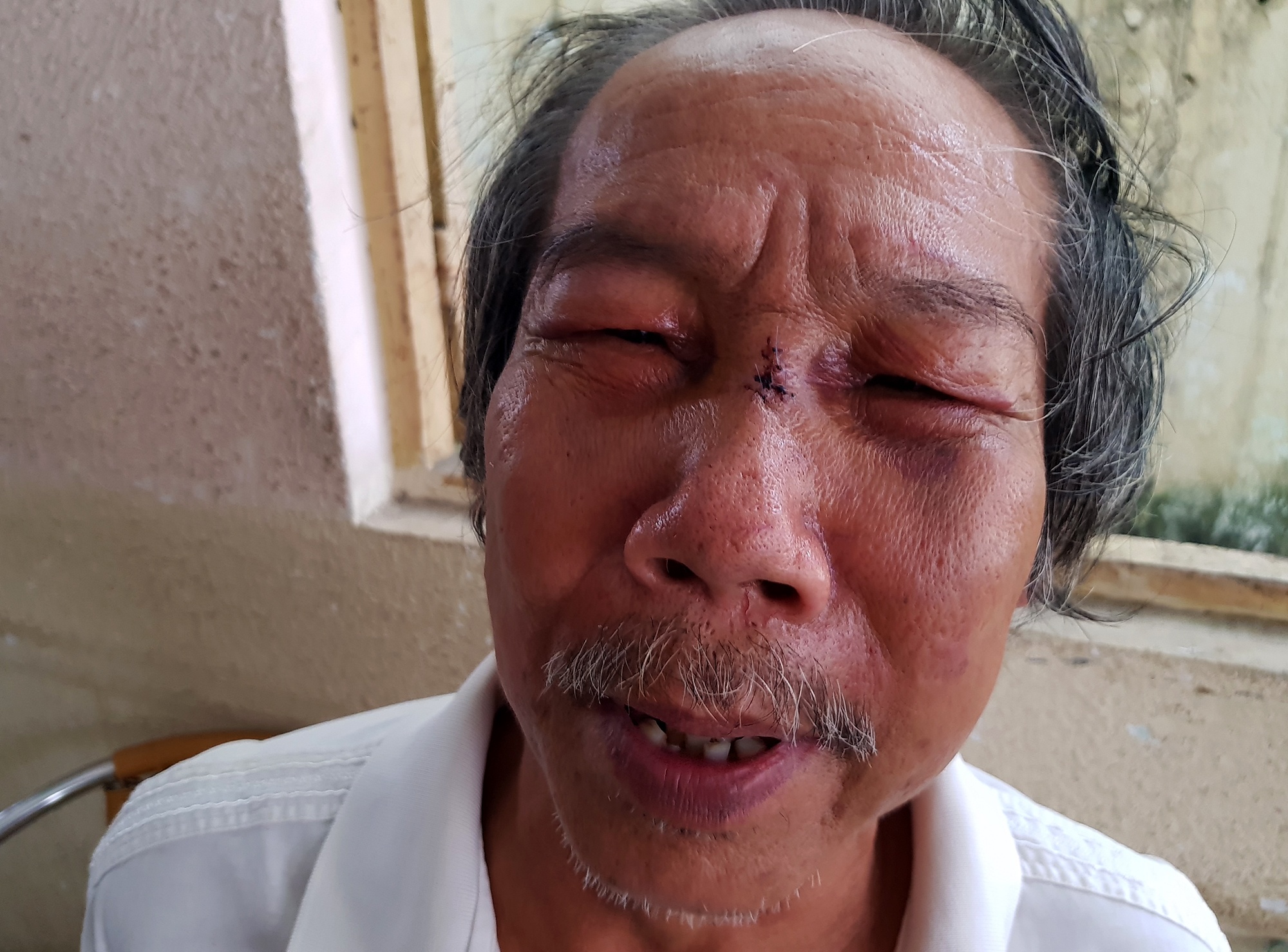 Bao ve danh nha tho 68 tuoi ngat xiu tung di tu vi buon ban ma tuy hinh anh