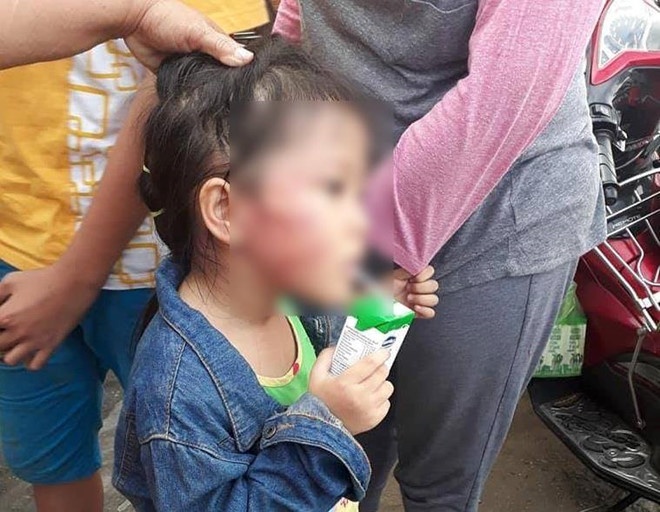 Bat khan cap bao mau tat be gai 5 tuoi nut xuong ham hinh anh