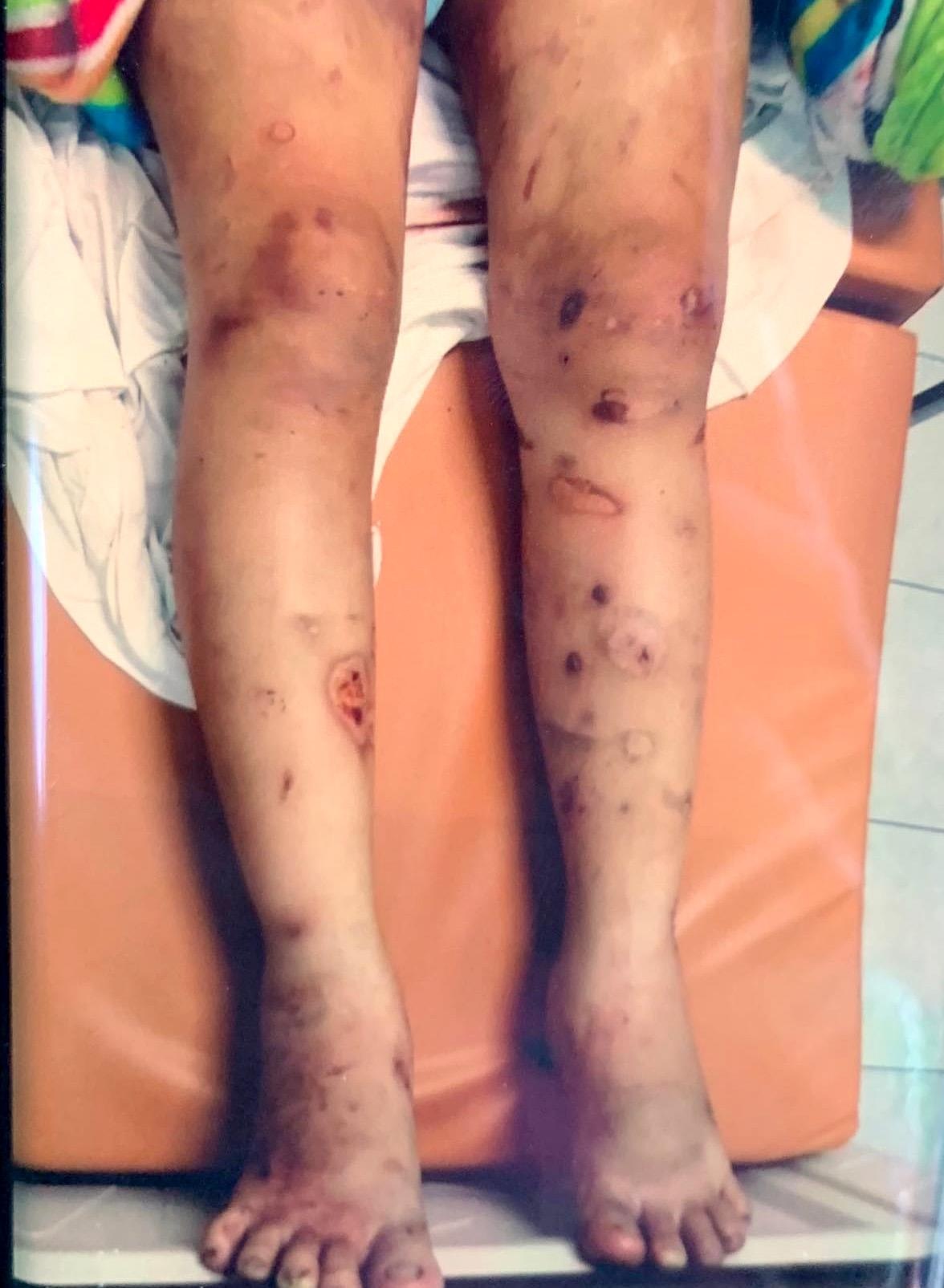 cô gái bị tra tấn đến xảy thai ảnh 2 co gai bi tra tan den xay thai anh 2