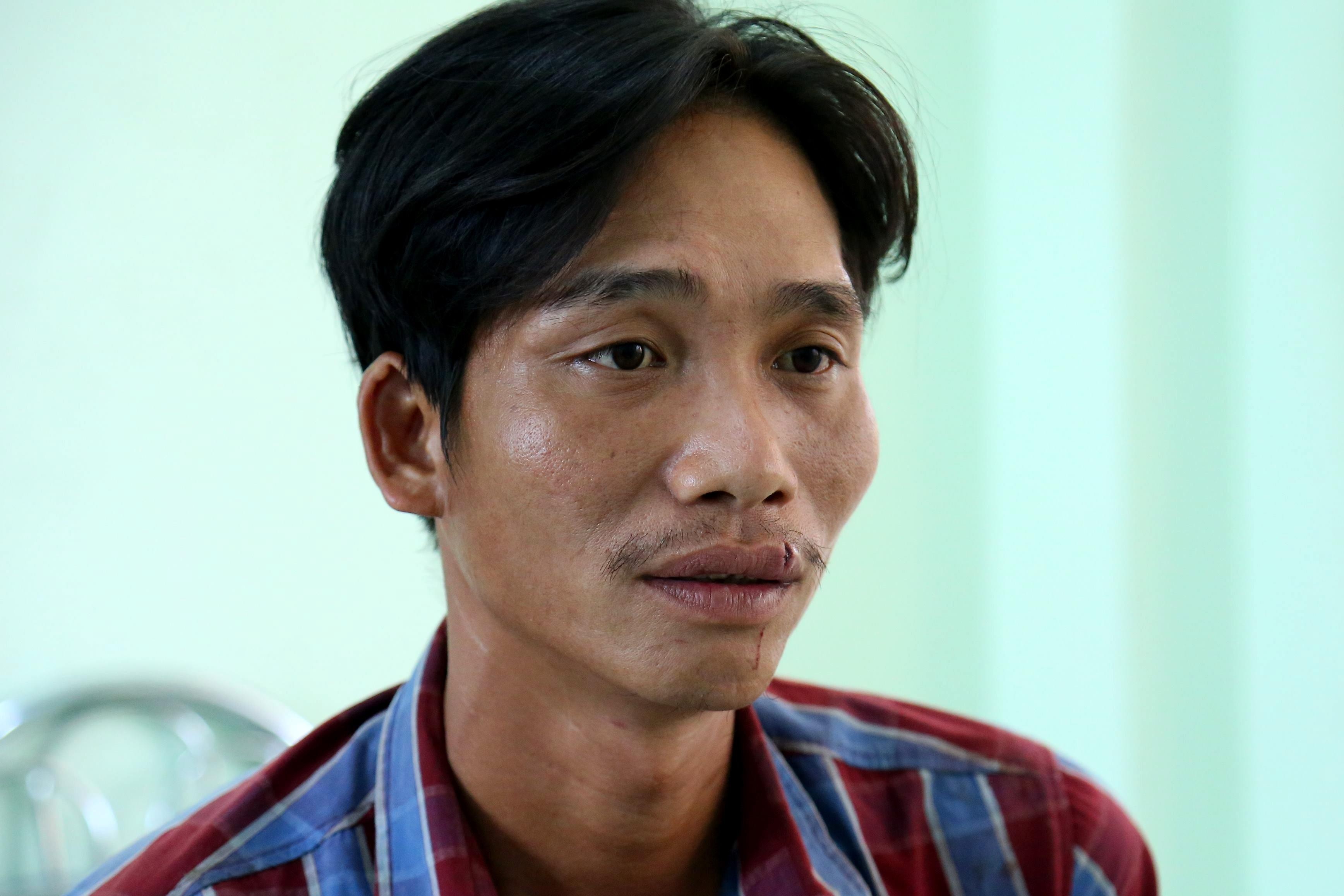 đâm bạn nhậu trọng thương ảnh 1 dam ban nhau trong thuong anh 1