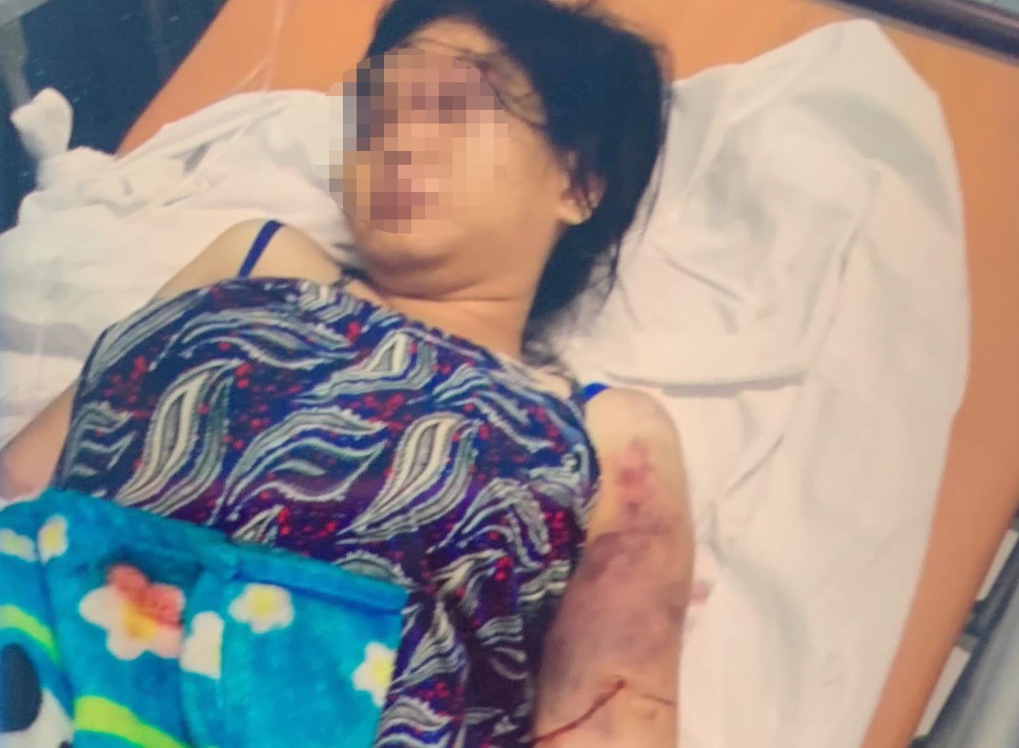 co gai bi tra tan den say thai anh 1