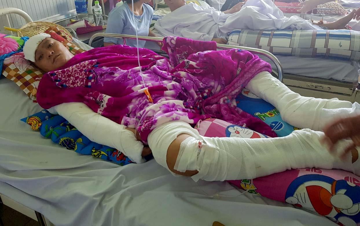 côn đồ chém nam thanh niên ảnh 2 con do chem nam thanh nien anh 2