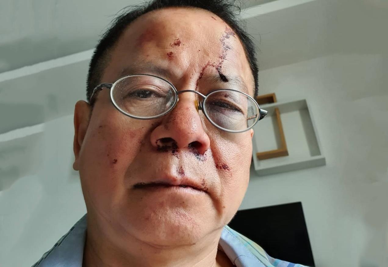 Viet kieu Duc to bi nhom thanh nien danh khi di hat karaoke o Sai Gon hinh anh