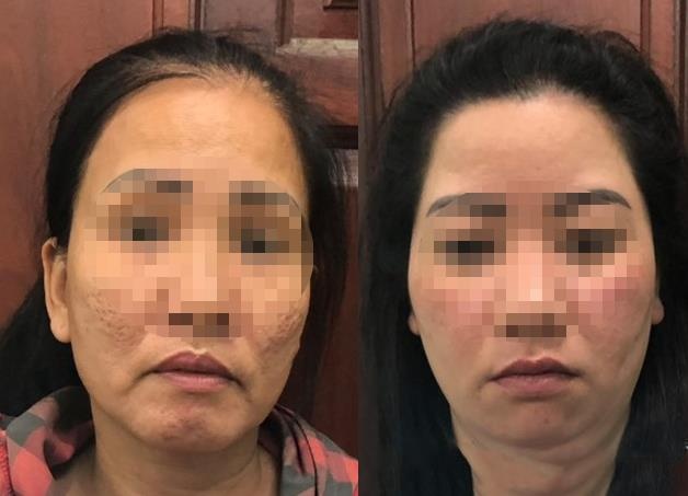 dan canh ban dam de trom cap anh 1