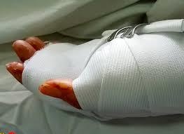 Nan nhan bi chem gan lia tay o TP.HCM da tu vong hinh anh