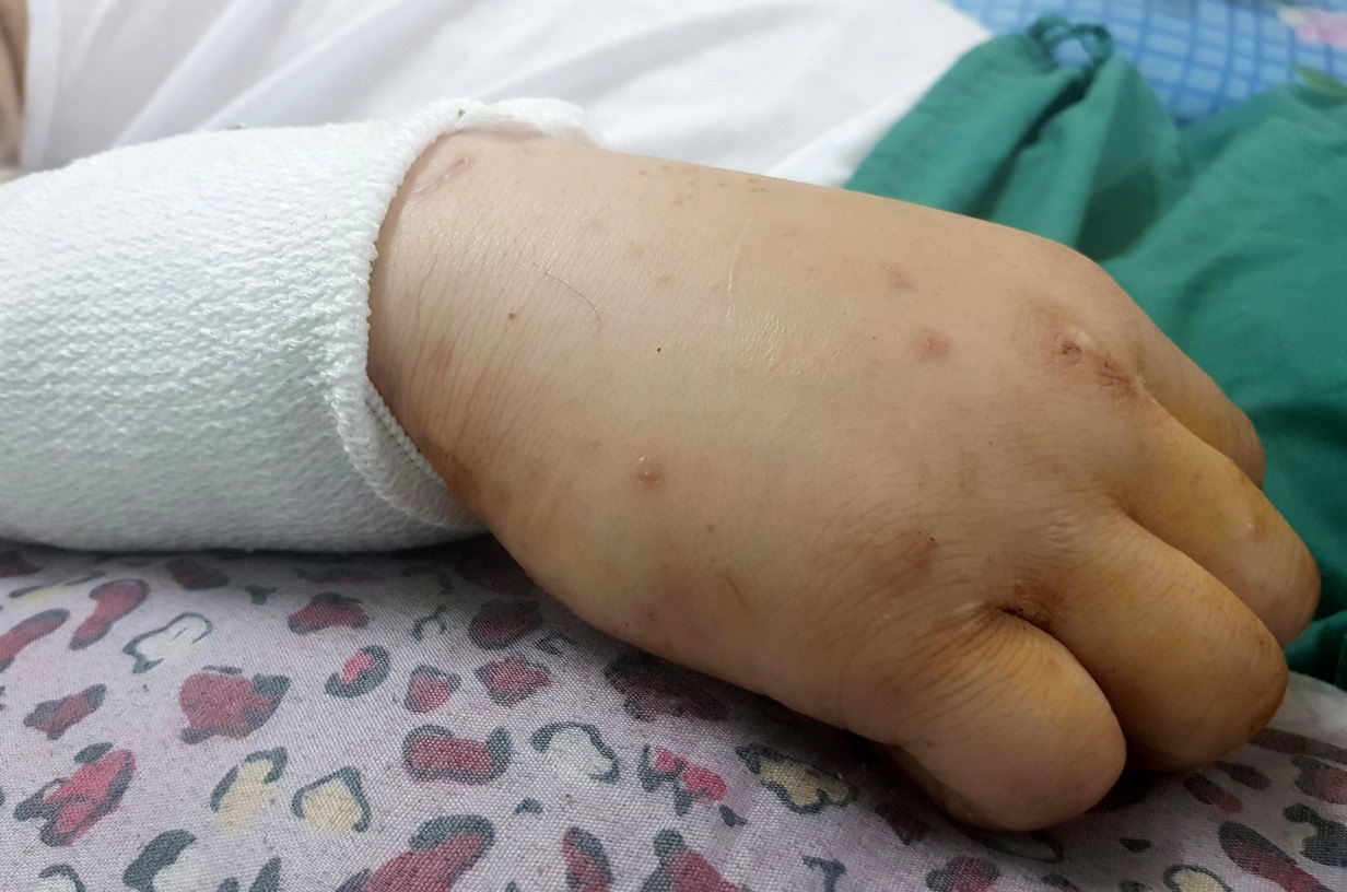 chém nhau ở sài gòn ảnh 1 chem nhau o sai gon anh 1