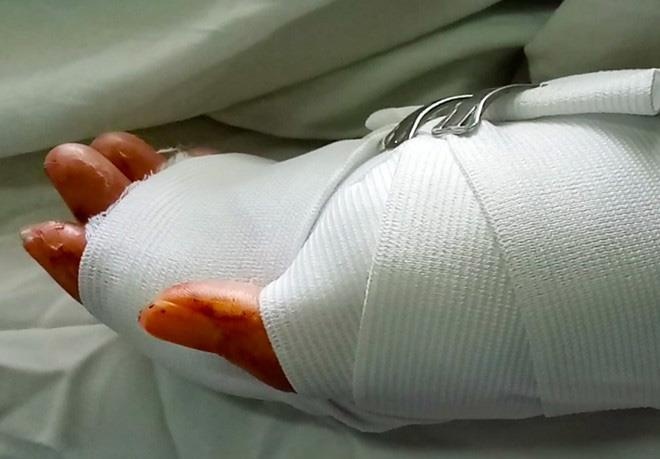 Khoi to 2 thanh nien chem gan lia tay doi thu o TP.HCM hinh anh