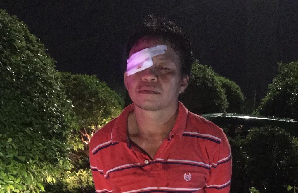 bat nghi pham cuop taxi anh 2