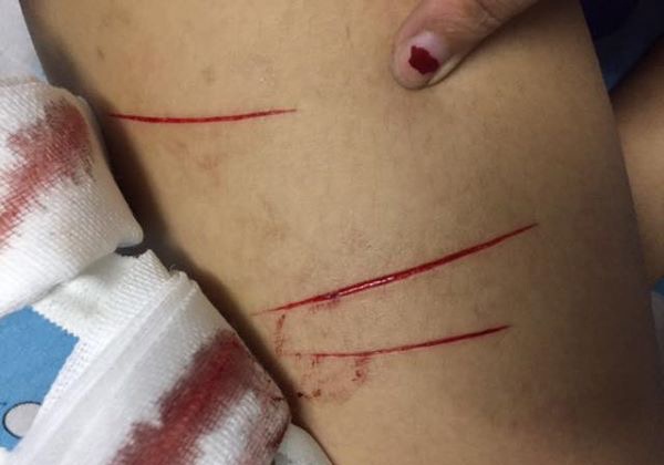 Nu sinh o TP.HCM bi rach dui hinh anh