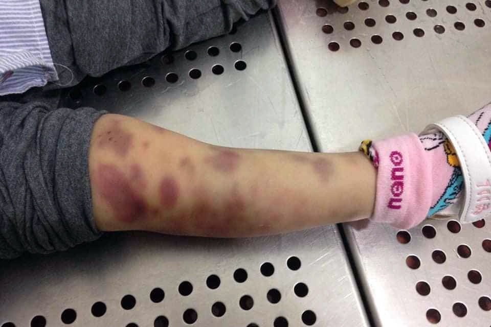 Tam giu nguoi me bao hanh con gai 3 tuoi hinh anh